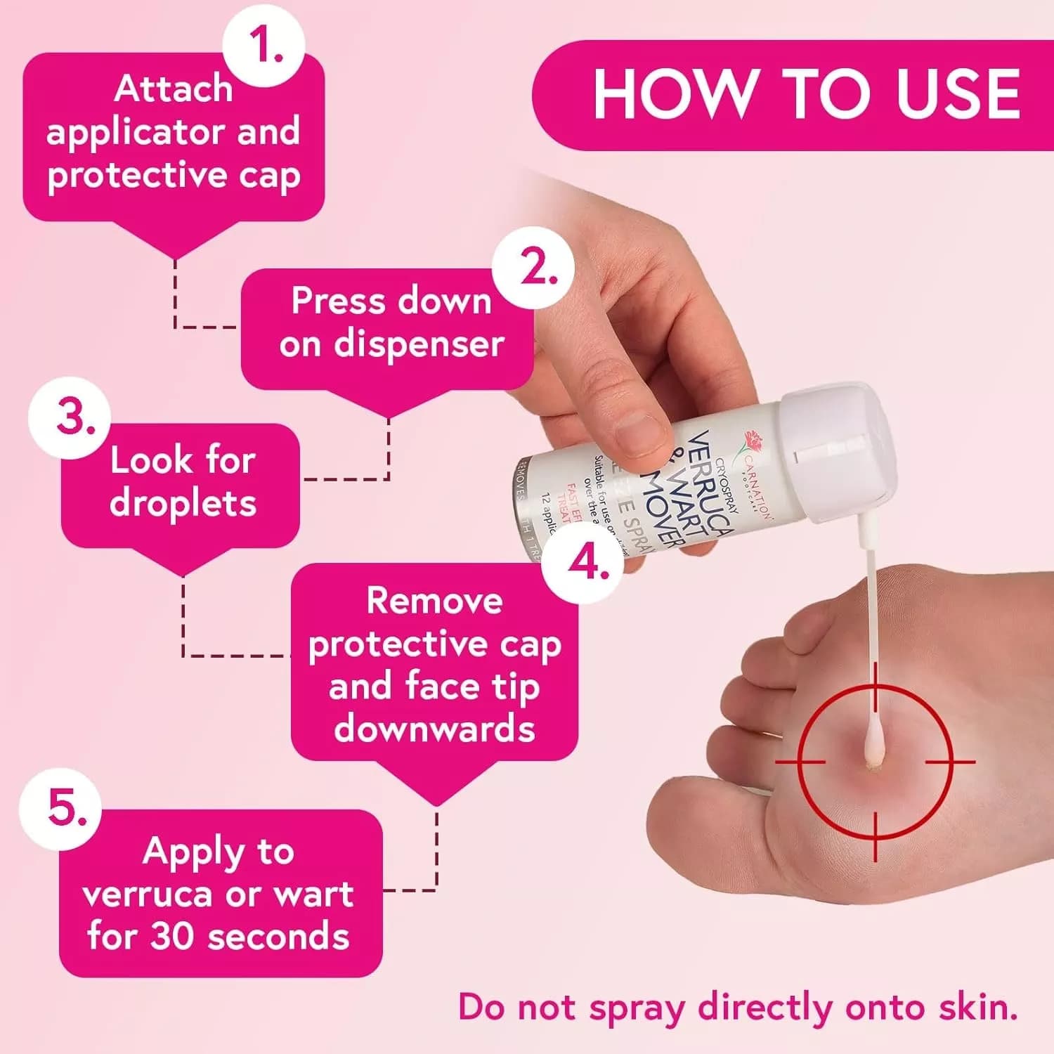 Carnation verruca and wart remover freeze spray 50ml 6